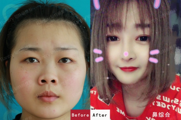΢ͼƬ_20190711091720_meitu_2.jpg