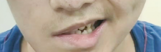 ͼƬ