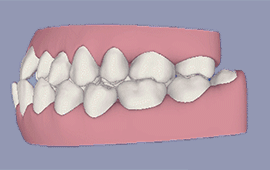 2.gif