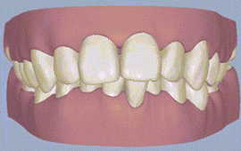 3.gif