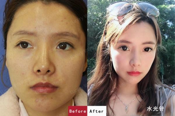 微信图片_201907110917201_meitu_3.jpg 微信图片_201907110917201_meitu_3.jpg